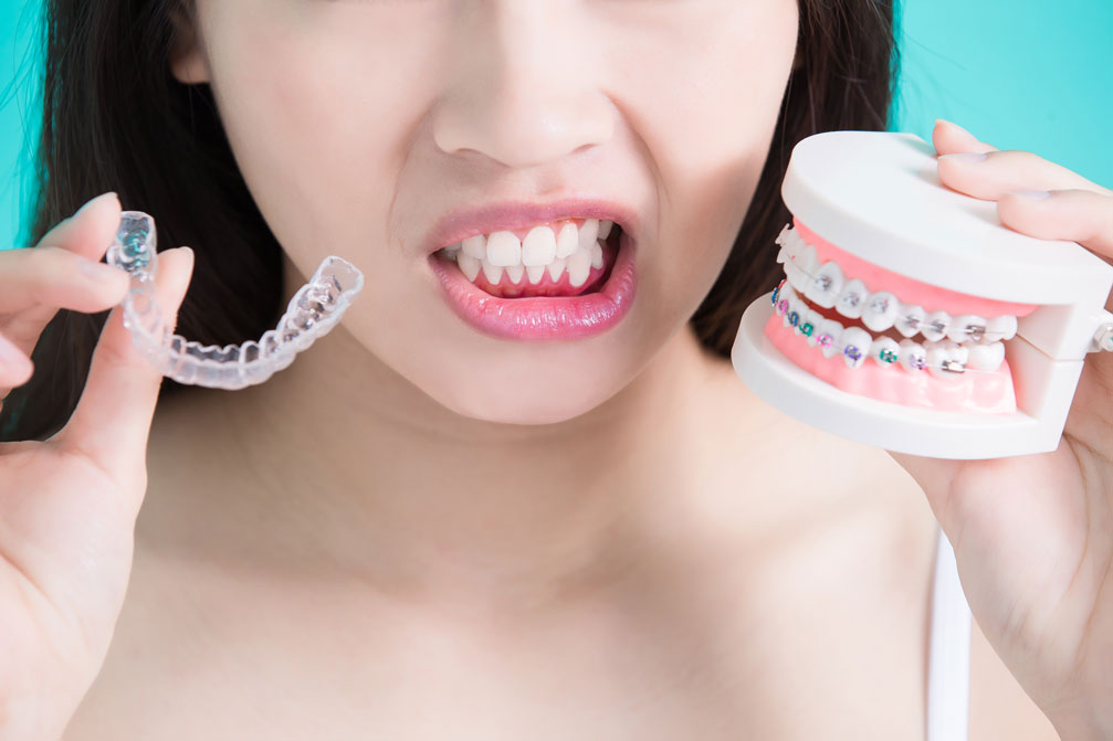 Compairing metal braces and Invisalign clear braces for teens in Anchorage